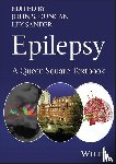  - Epilepsy