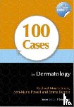 Morris-Jones, Rachael, Powell, Ann-Marie, Benton, Emma - 100 Cases in Dermatology