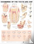 Anatomical Chart Company - Disorders of the Teeth and Jaw Anatomical Chart