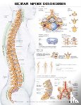 Anatomical Chart Company - Human Spine Disorders Anatomical Chart