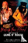 Davis, Stephen - Watch You Bleed