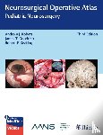  - Neurosurgical Operative Atlas: Pediatric Neurosurgery