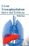  - Liver Transplantation: Issues and Problems