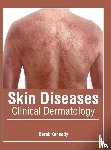  - Skin Diseases: Clinical Dermatology