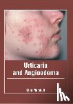  - Urticaria and Angioedema