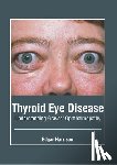 Harrison, Edgar - Thyroid Eye Disease: Understanding Graves' Ophthalmopathy