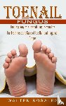 Rosales, Walter - Toenail Fungus