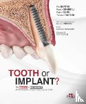 Generali, Paolo, Gorni, Fabio, Testori, Tiziano - Tooth or Implant