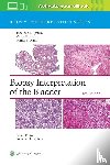 Epstein, Jonathan I., Reuter, Victor E., Amin, Mahul B. - Biopsy Interpretation of the Bladder: Print + eBook with Multimedia