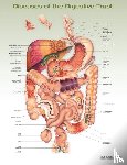 Anatomical Chart Company - Diseases of the Digestive Tract Anatomical Chart