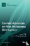 Caruntu, Constantin - Current Advances on Non-Melanoma Skin Cancer