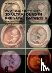 Chaoui, Rabih, Heling, Kai-Sven - 3D Ultrasound in Prenatal Diagnosis