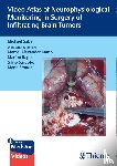 Sabel, Michael Christoph - Video Atlas of Neurophysiological Monitoring in Surgery of Infiltrating Brain Tumors