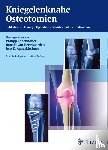  - Kniegelenknahe Osteotomien