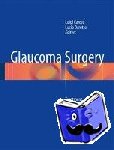  - Glaucoma Surgery - Treatment and Techniques