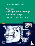 Neff, Andreas - Atlas der Kiefergelenkerkrankungen und -verletzungen