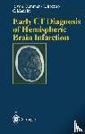 Rudiger v. Kummer, Luigi Bozzao, Claude Manelfe - Early CT Diagnosis of Hemispheric Brain Infarction