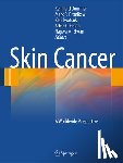  - Skin Cancer - A World-Wide Perspective