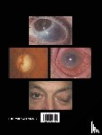Erna E Kritzinger, Barry E Wright, Annette Schildwachter - Auge Und Allgemeinerkrankungen