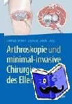 Andreas B. Imhoff, Andreas Lenich - Arthroskopie und minimal-invasive Chirurgie des Ellenbogens