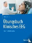 Kursawe, Hubertus - Ubungsbuch Klinisches EEG