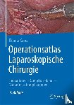 Carus, Thomas - Operationsatlas Laparoskopische Chirurgie