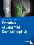  - Essentials of Cemented Knee Arthroplasty