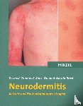 Roos, Thomas C., Brost, Harald - Neurodermitis
