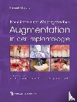  - Knochen- und Weichgewebeaugmentation in der Implantologie