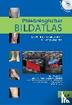  - Phlebologischer Bildatlas