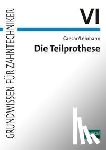 Caesar, Hans H., Lehmann, Klaus M. - Die Teilprothese