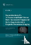 Stille, Maik - Reconstruction of a 3-Dimensional Brain Volume from Fluorescent Images and its Co-Registration with Magnetic Resonance Imaging
