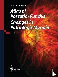 Tokoro, Takashi - Atlas of Posterior Fundus Changes in Pathologic Myopia