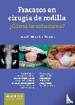 Monllau García, Juan C. - Fracasos en cirugía de rodilla ¿Cómo lo soluciono?