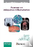 Cervera, Ricard, Grau, Josep M., Milisenda, José C. - Avances en miopatías inflamatorias