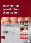 Dijk, Johan van, Spijkervet, Fred, Tromp, Jan - Atlas van de parodontale diagnostiek