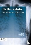  - De thoraxfoto - een stapsgewijze beoordeling