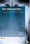  - De thoraxfoto