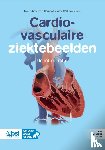  - Cardiovasculaire ziektebeelden
