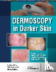 Chatterjee, Manas, Neema, Shekhar, Malakar, Subrata - Dermoscopy in Darker Skin