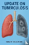 El Molaka El Qulii, Zouhair - Update on tuberculosis