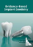 Bailey, Preston - Evidence-Based Implant Dentistry