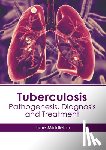 Middleton, June - Tuberculosis: Pathogenesis, Diagnosis and Treatment