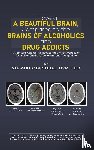Odendhal, DVM - I Have a Beautiful Brain, Compared to the Brains of Alcoholics and Drug Addicts