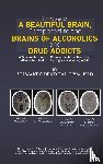 Odendhal, DVM - I Have a Beautiful Brain, Compared to the Brains of Alcoholics and Drug Addicts