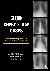 200 Chest X-Ray Cases
